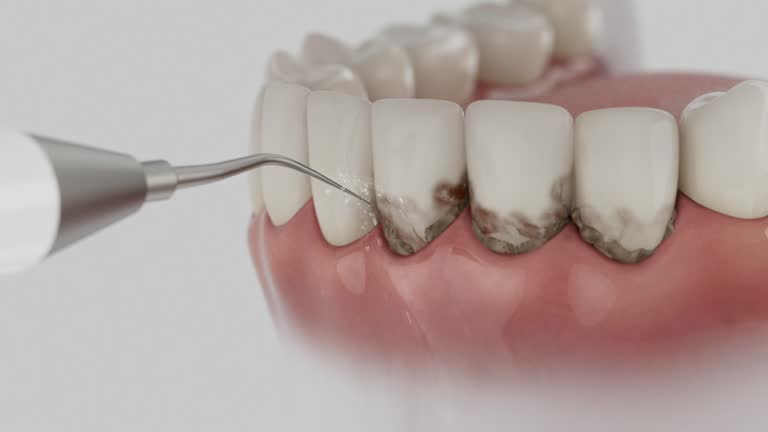 Trusted Teeth Cleaning And Checkup service in French Camp, CA - Dentist Open Now